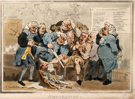 An illustration of an amputation. By Thomas Rowlandson, S.W. Fores, London, 1793. Image source: Wellcome Library, London. Used under Creative Commons Attribution-Non-Commercial version 2.0 licence